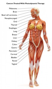 cancers treated with PDT