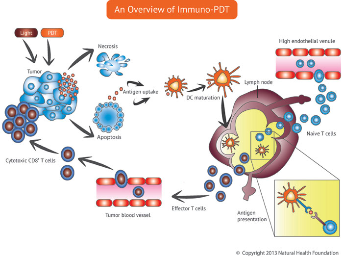 Diagram-Immuno-PDT