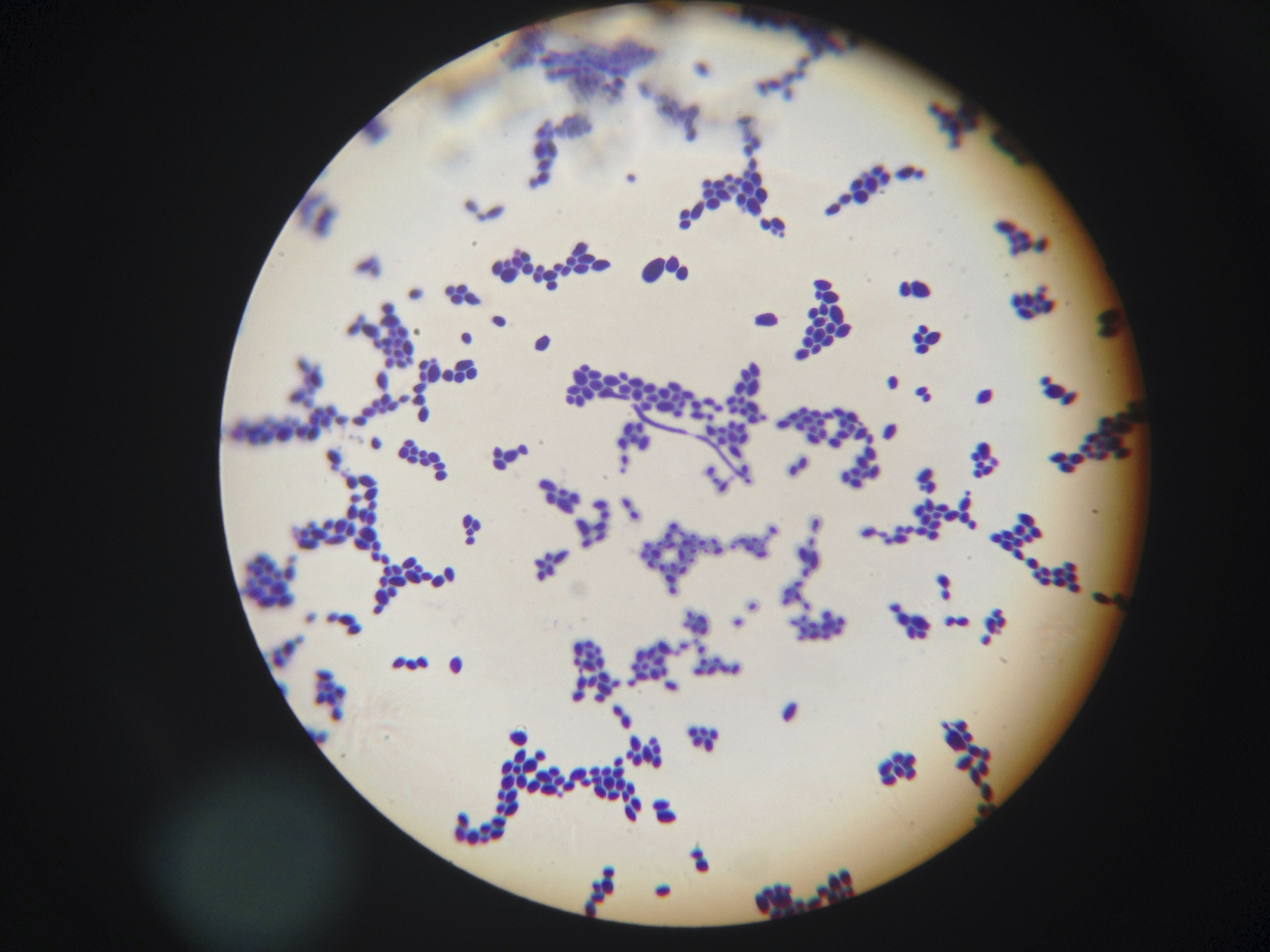 Споры candida. Кандида альбиканс микроскопия. Кандида альбиканс под микроскопом. Грибы кандида микроскопия мазка.